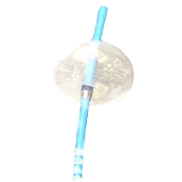 Durable Stone Extraction Catheter Sale Or Rent Near Me Goldstar