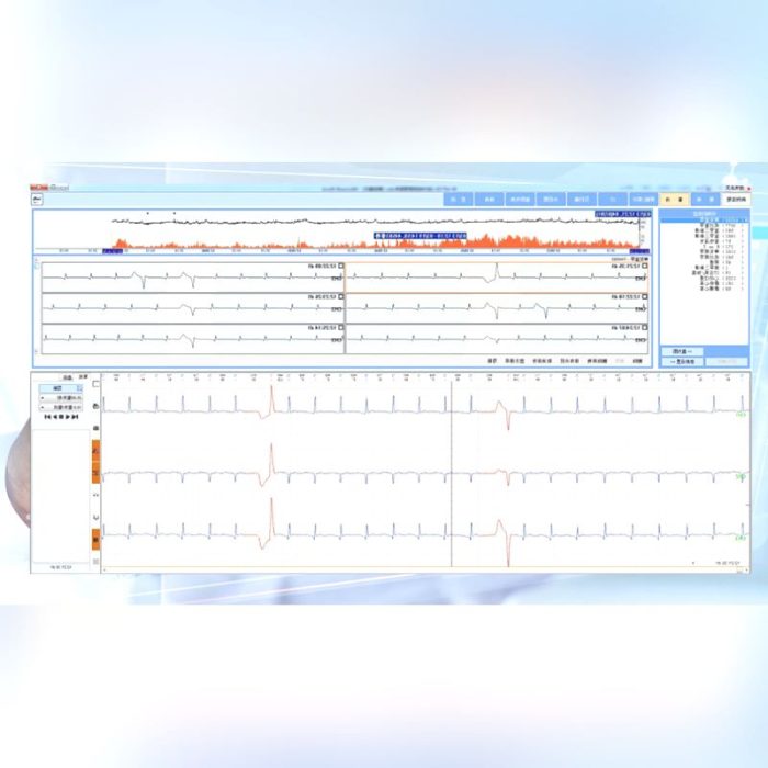 12-Channel Holter Monitor 3