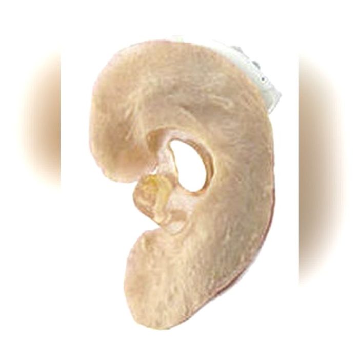 Auricular Cosmetic Prosthesis 1
