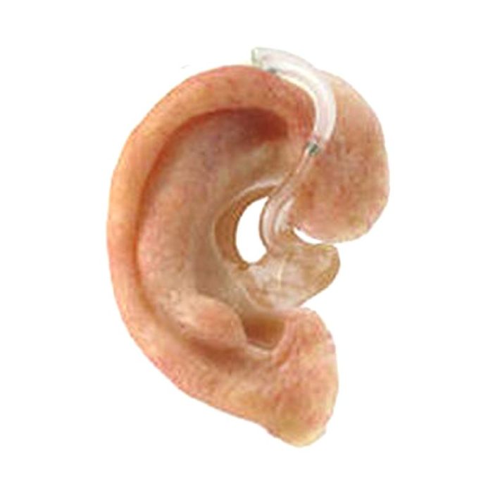 Auricular Cosmetic Prosthesis