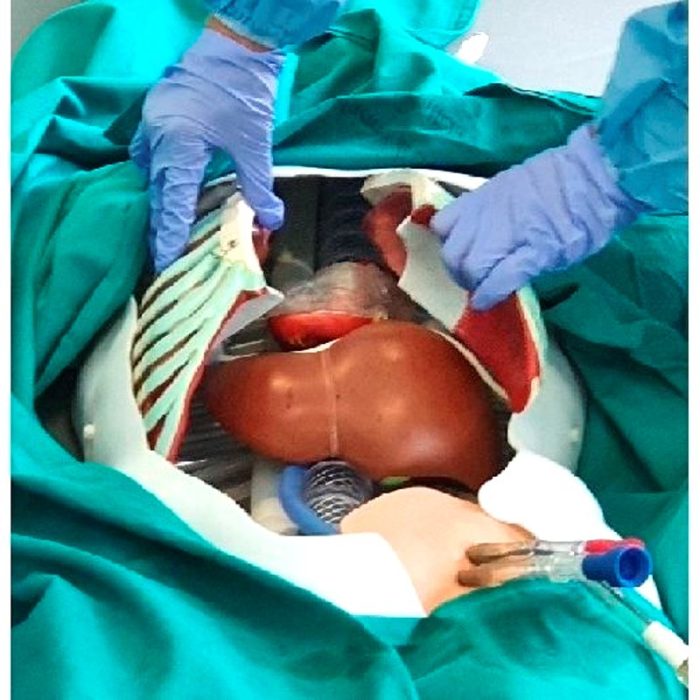Cardiac Surgery Simulator