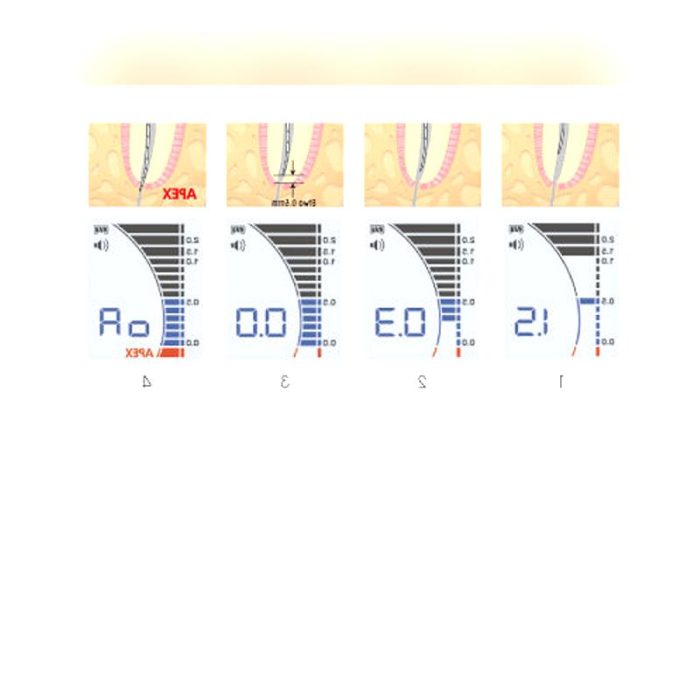 Dental Apex Locator 2