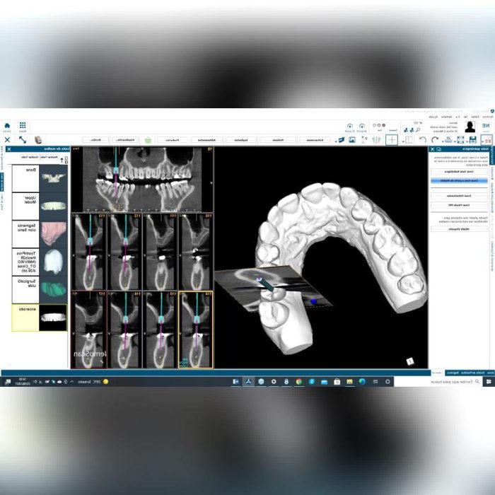Dental Implantology Software 1