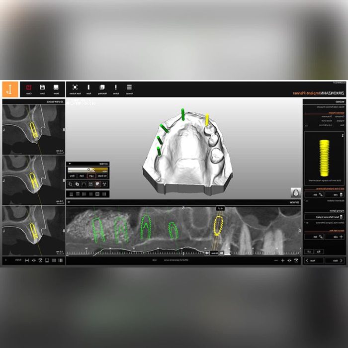 Dental Laboratory Software 2