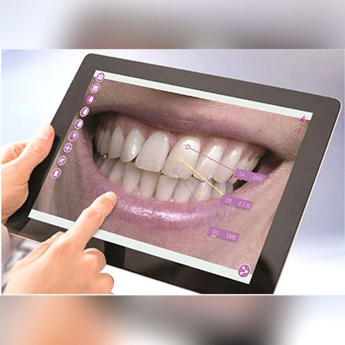 Dental Laboratory Software