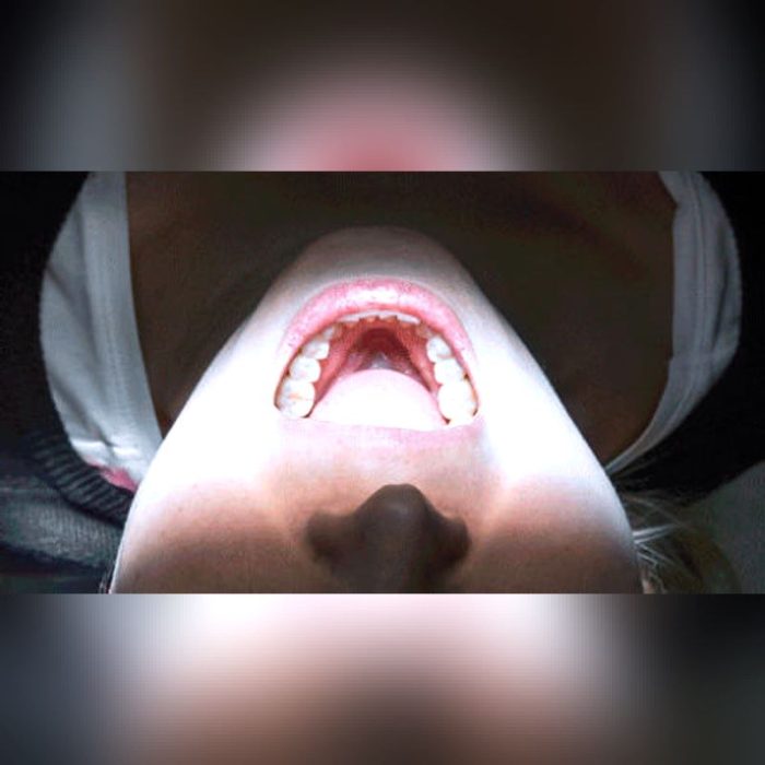Dental Light 3