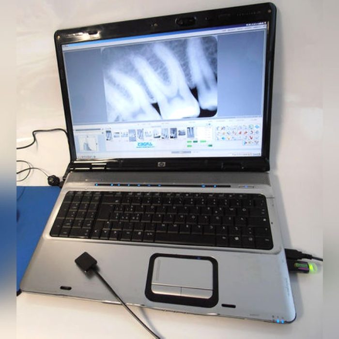 Dental Radiography Intra-Oral Detector 2