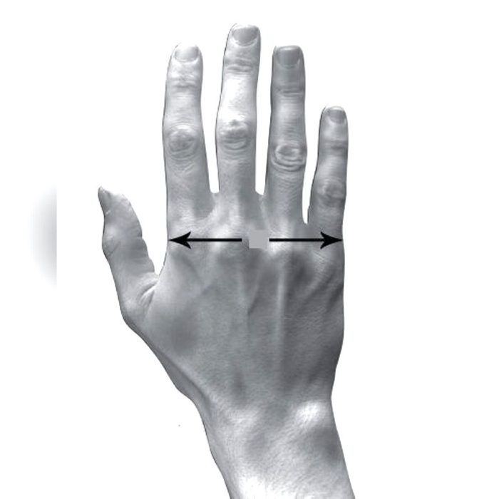 Finger Orthosis 2