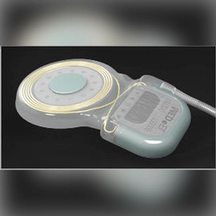 Internal Component Cochlear Implant 3