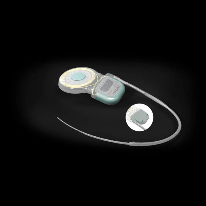 Internal Component Cochlear Implant