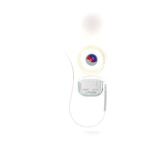 Internal Component Cochlear Implant 8