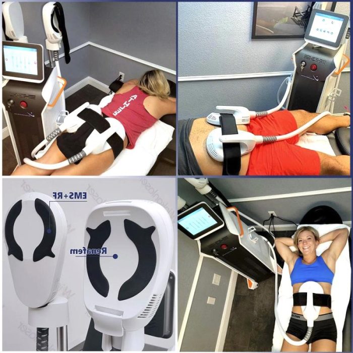 Magnetic Pulse Body Contouring Unit 3