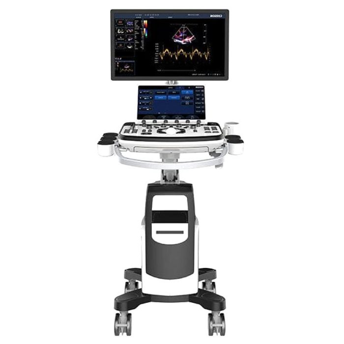 On-Platform Ultrasound System