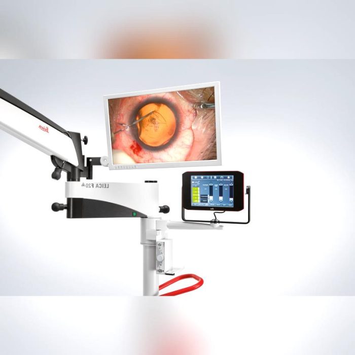 Ophthalmic Surgery Microscope 5
