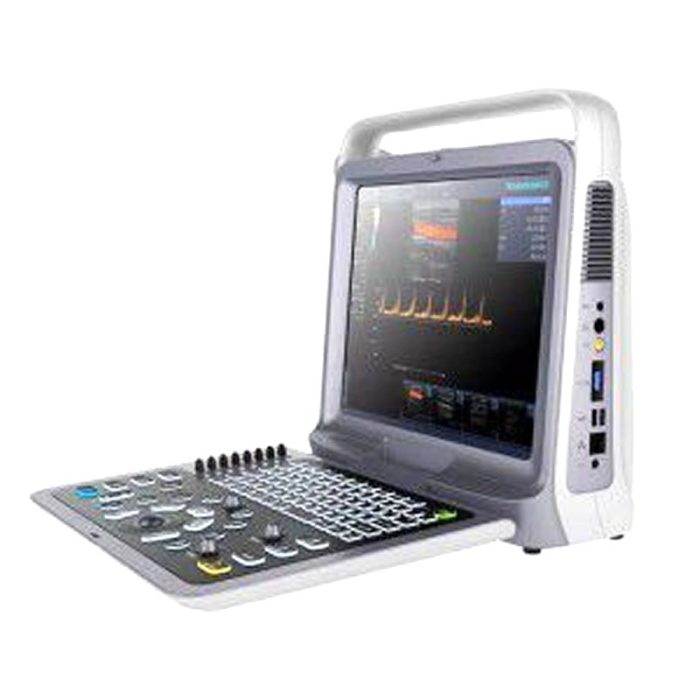 Portable Ultrasound System