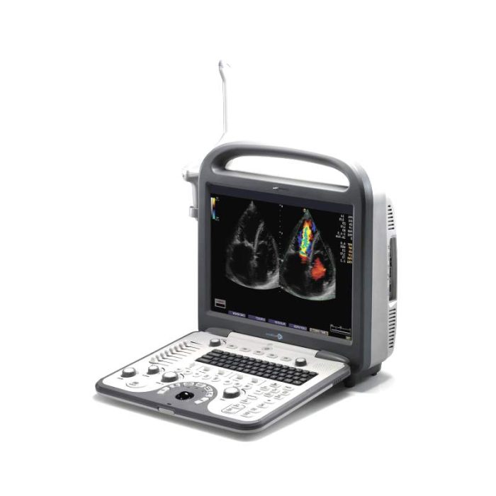With Trolley Ultrasound System