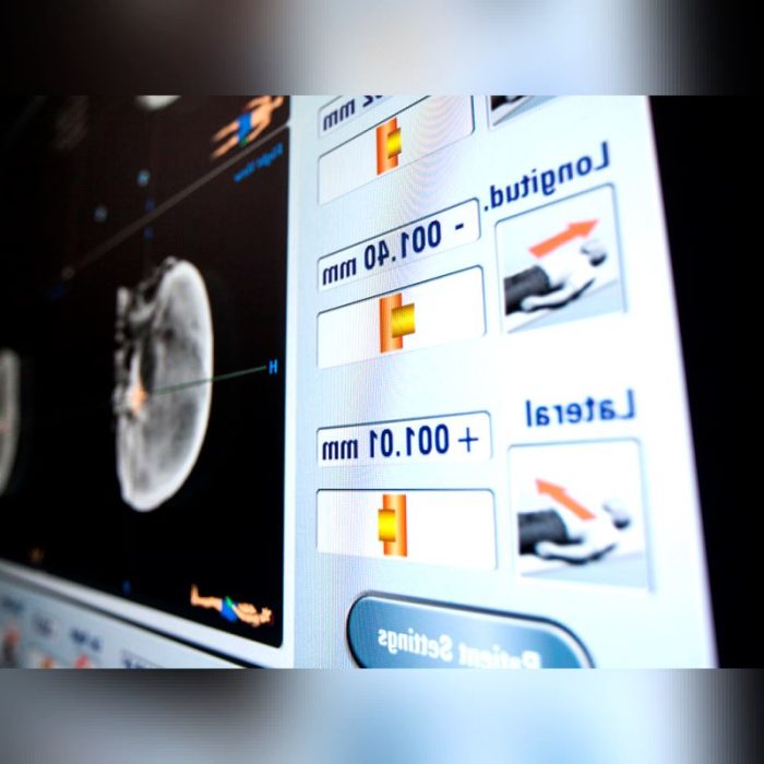 Radiosurgery Qa System 2