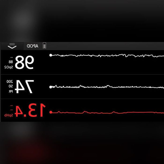 Respiratory Rate Patient Monitor 3