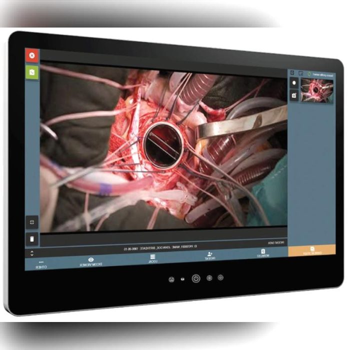 Surgical Video Recorder 1