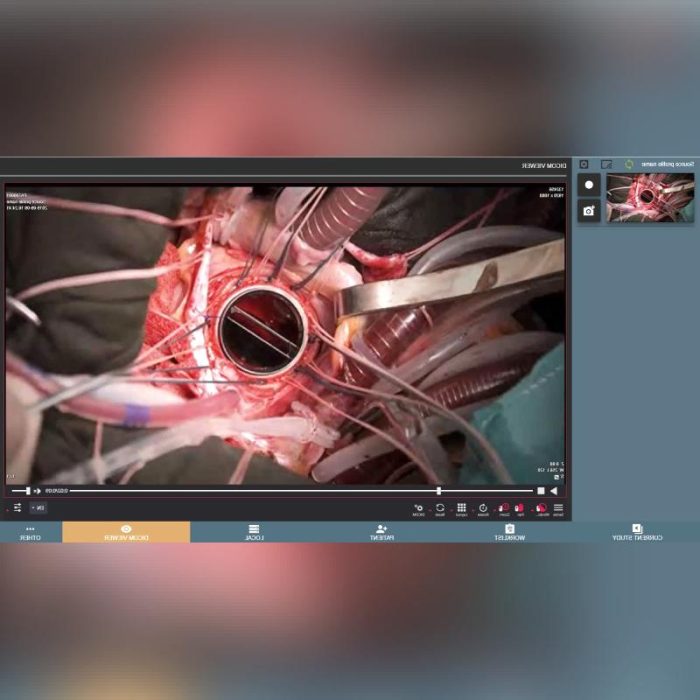 Surgical Video Recorder 4